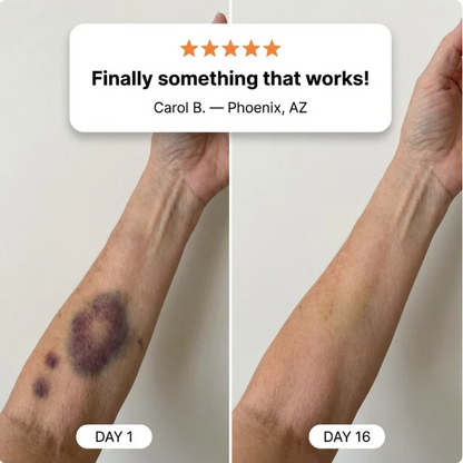 Lorivexa Bruise Repair & Skin-Strengthening Cream