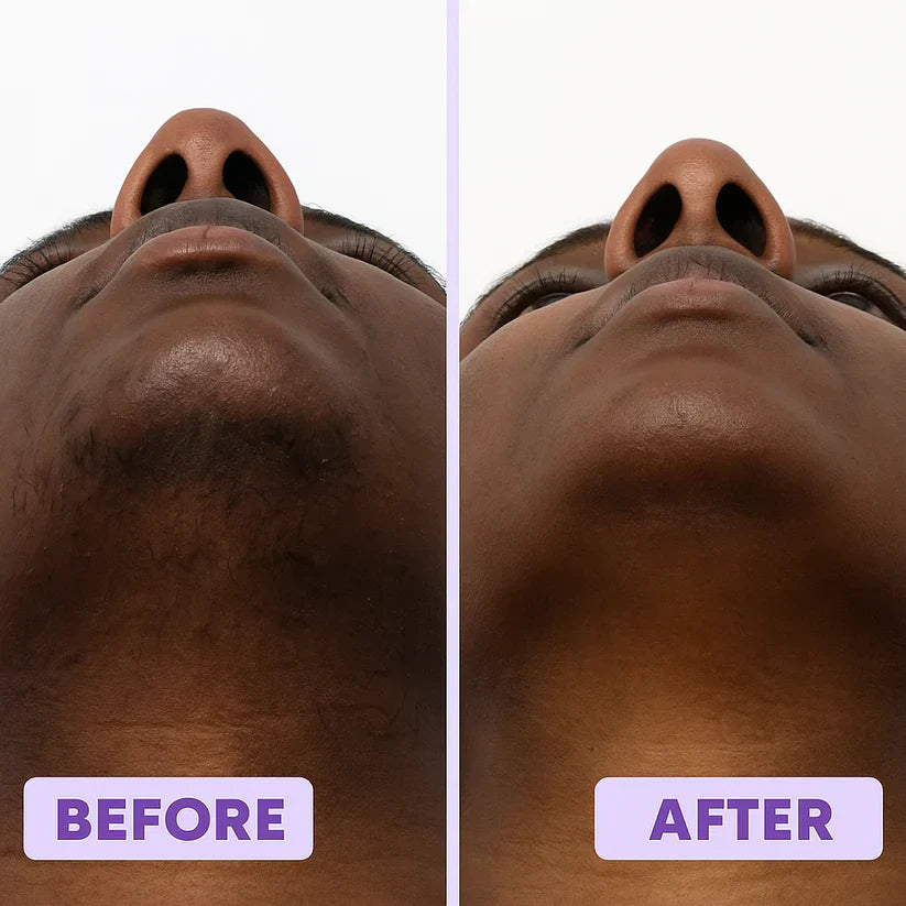 Facial Hair Removal Cream